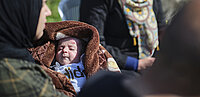 Eine Mutter mit ihrem Kind, das an der Schmetterlingskrankheit leidet wird im Kinderhospital in Bethlehem gut versorgt.